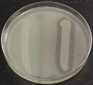 casein hydrolysis test|22.6: Hydrolytic and Miscellaneous Media .